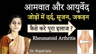 आमवात और आयुर्वेदिक चिकित्सा - सम्पूर्ण जानकारी || Rheumatoid Arthritis and Ayurveda || RA Treatment