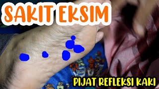 PIJAT REFLEKSI ATASI EKSIM - DERMATITIS ATOPIK - ECZEMA