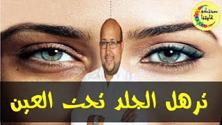 وصفات للتخلص من مشاكل الهالات السوداء و الشيخوخة تحت العين  -  الدكتورعماد ميزاب -