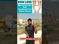 Bow legs problems ✅#shorts #shortsviral #shortsyoutube #shortsbeta #shortsindia #fitness #bowlegs