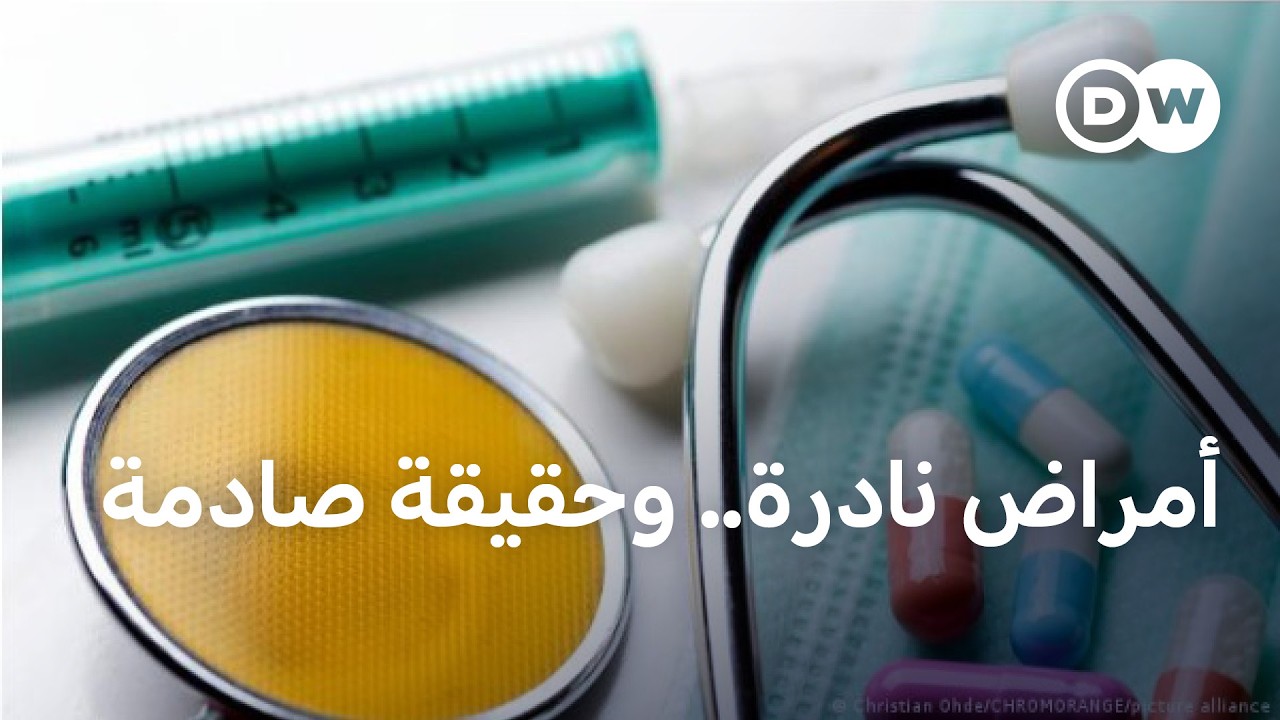 ����� ����.. ����� ���� ������ ��� ����Ͽ | ���� �����
 - نشر قبل 57 دقيقة