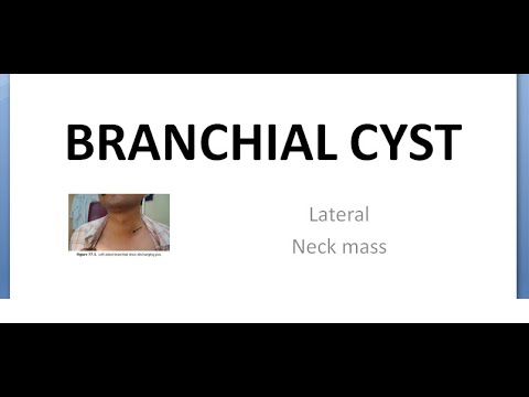 Video: Ce este un coș branchial?
