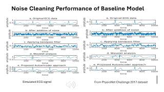 PRE-RECORDED VIDEO: PeRConAI - Noise Cleaning of ECG on Edge Device Using Convolutional Sparse Cont