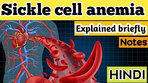 Apa yang kamu ketahui tentang penyakit sickle cell anemia pdf