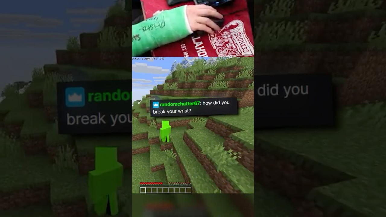 How I ACTUALLY Broke My Wrist…