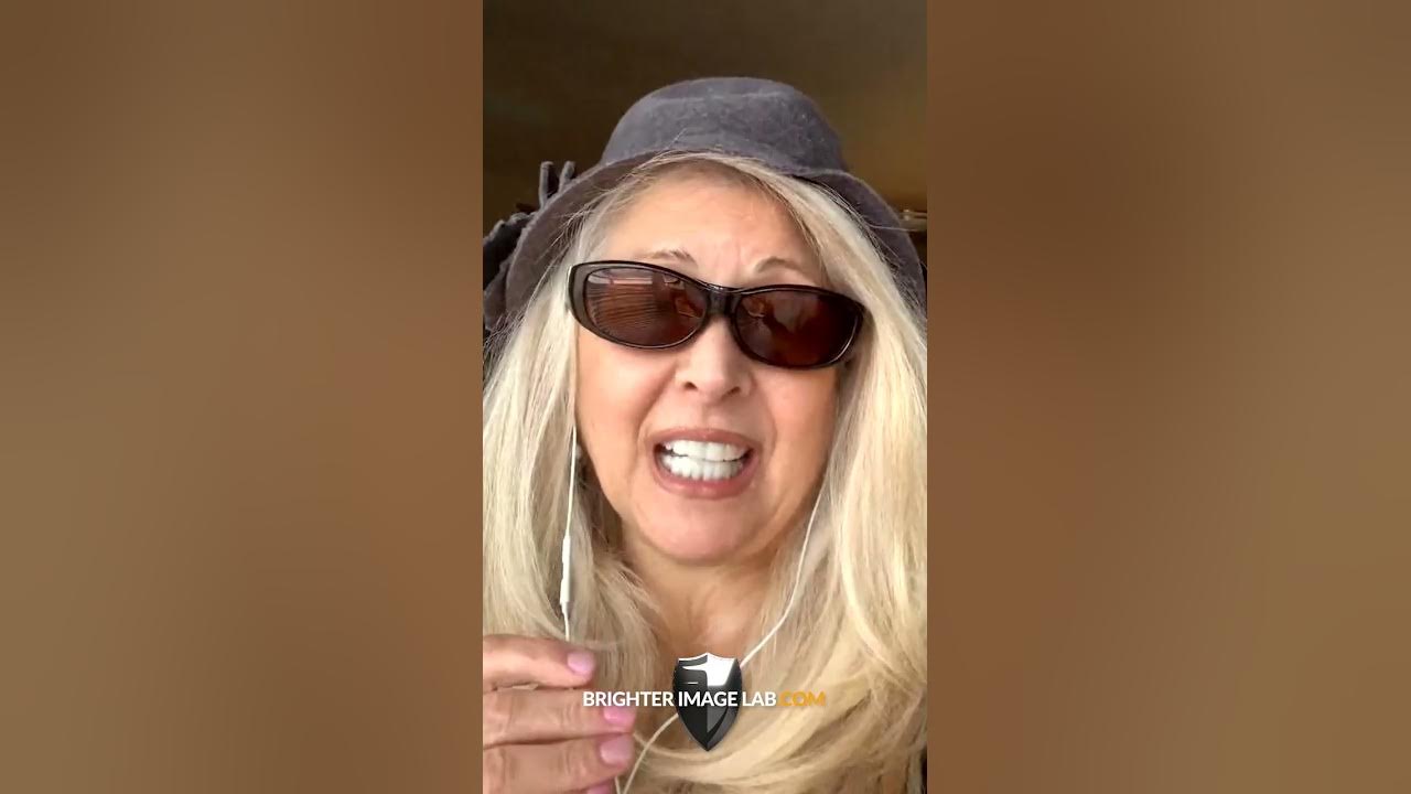Monica's Makeover Magic No Surgery Needed! You Won't Believe The