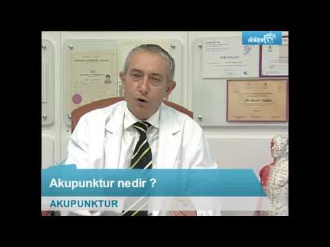 Akupunktur Nedir?