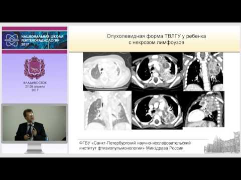 П.В. Гаврилов - Первичные формы туберкулеза у детей