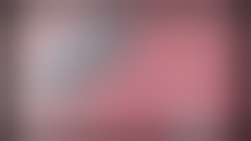 Colonoscopy: Tips for Clip Closure of EMR Defects