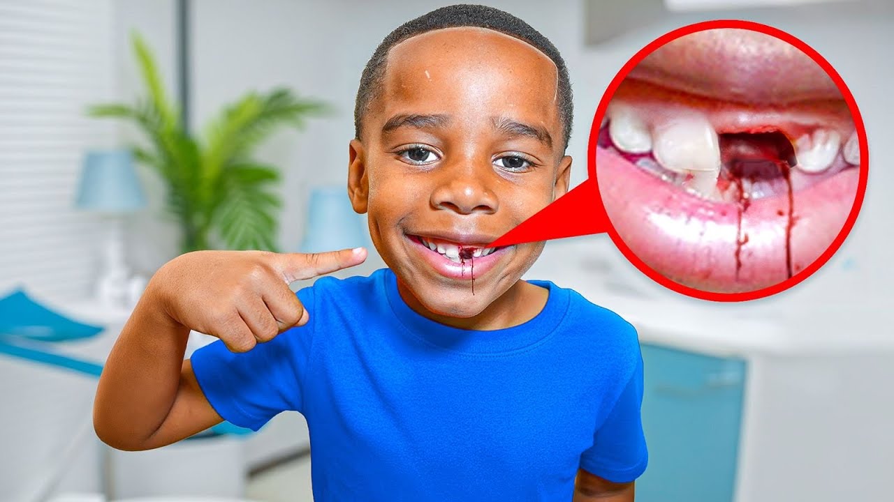 RICO’S TOOTH BROKE… Now He Has No CRUSH 💔