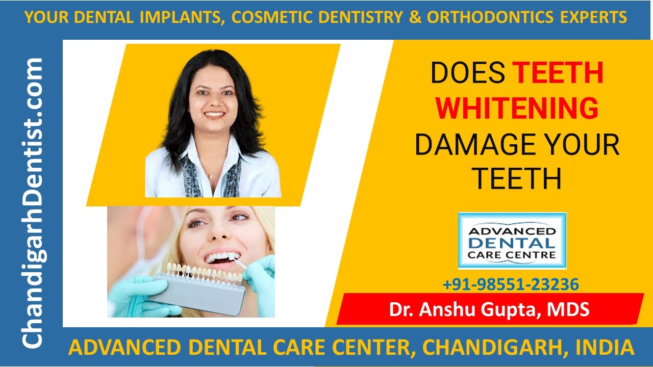 IS TEETH WHITENING HARMFUL BEST LASER TEETH WHITENING CHANDIGARH