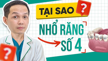 Tại Sao Phải Nhổ Răng 4 Khi Niềng Răng Giảm Hô | Nha Khoa Hina
