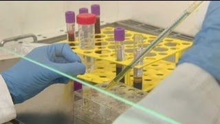 Now 14 adults with HIV have been 'functionally cured'