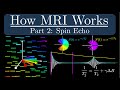 How mri works  part 2  the spin echo