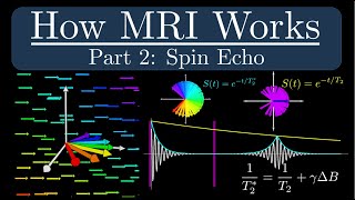 How MRI Works - Part 2 - The Spin Echo