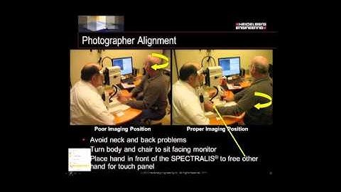 Optimizing IR and OCT Imaging With the SPECTRALIS®