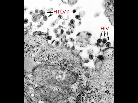 Wideo: Jak ustalić, czy Twój partner jest zagrożony HIV lub AIDS?