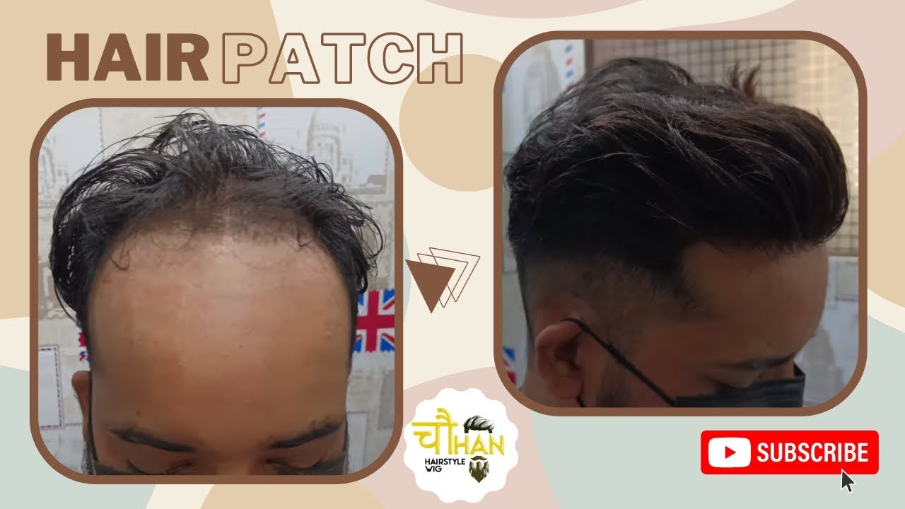 Hairline Hair Patch for Receding Hairline Customize Hairline Patch
