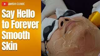 Say Hello To Forever Smooth Skin | Laser Hair Removel | Awish Clinic | #viral #smoothskin