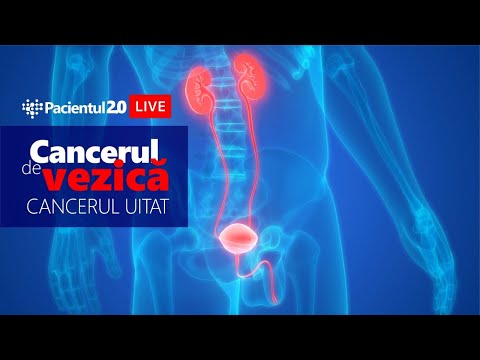 Video: Nivelurile De Expresie CCDC6 și USP7 Sugerează Noi Opțiuni De Tratament în Cancerul Vezicii Uroteliale De înaltă Calitate