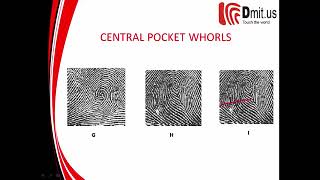 🔴 Dermatoglyphics Multiple Intelligence Test  Unit 4 ⚡