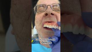 Elderly and fake teeth !