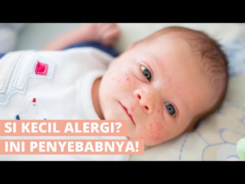 Hati-Hati! Ternyata Ini Makanan Pemicu Alergi pada Bayi