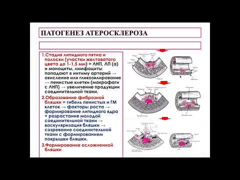 Синдром коронарной недостаточности