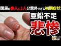 知らないと絶対に気付かない亜鉛が不足しているときに起こるサイン12選【ゆっくり解説】