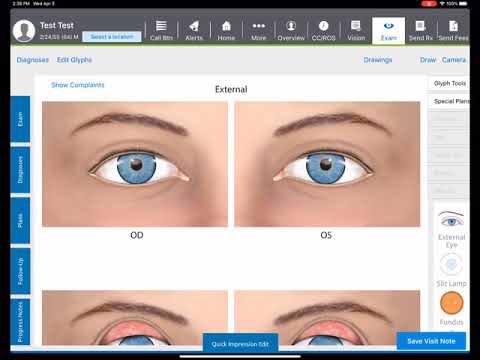 Charting a Comprehensive Exam in under 1 Minute with Eyefinity EHR
