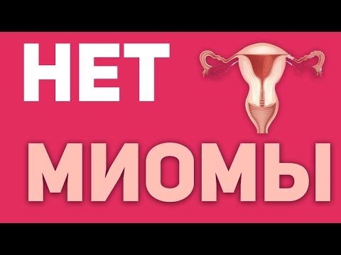 Video: Endomeetriumi Hüperplaasia - Sümptomid, Ravi, Näärmete Endomeetriumi Hüperplaasia