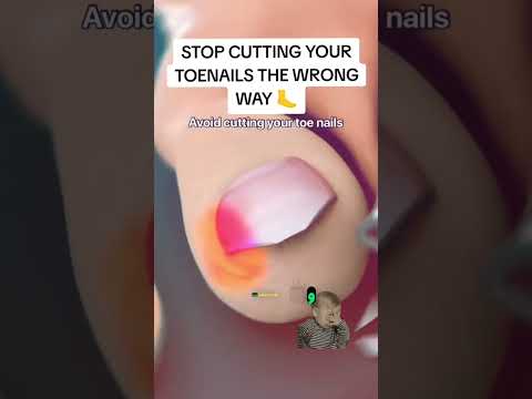 ناخن پات توی گوشت رفته تو خونه خوبش کن