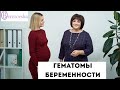 Гематомы беременности - Др. Елена Березовская