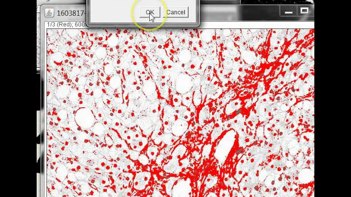 Quantifying Stained Liver Tissue Area Using ImageJ