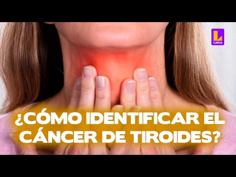 Aprende a identificar