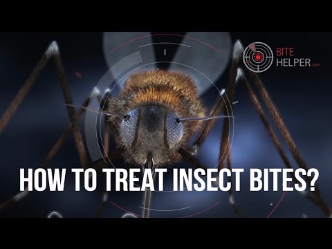 How to treat insect bites? - YouTube