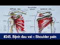 #245. Bệnh đau vai và tổn thương cơ quay khớp vai - Shoulder pain and rotator cuff injury