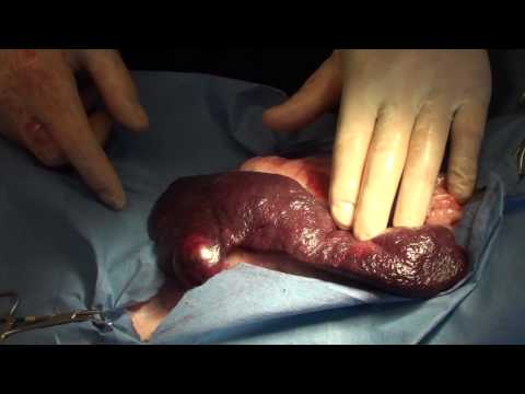 Video: Twisted Spleen In Dogs