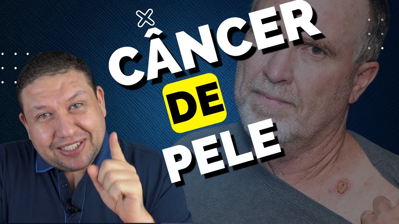CÂNCER DE PELE !!  Toda ferida na pele é Câncer ? Quando suspeitar de câncer de pele.