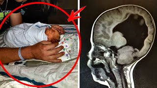 Ребенок родился "без мозга"... Спустя 3-года врач проводит обследование и обнаруживает это...