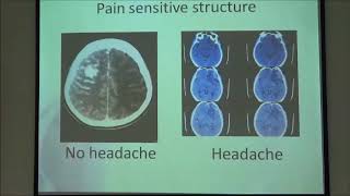 Practical approach to headache 4th The director’s cut