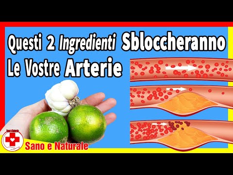 Video: 3 modi per liberare le arterie ostruite in modo naturale