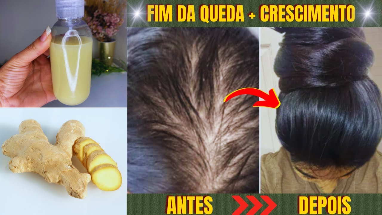 COMO USAR GENGIBRE PARA ACABAR COM A QUEDA E FAZER O CABELO CRESCER MAIS RÁPIDO