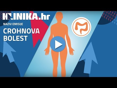 Video: Crohnova Bolest: činjenice, Statistika I Vi