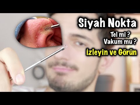 Siyah Noktalara DOKTOR YÖNTEMİ !