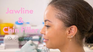 Jawline & Chin Filler Before and After 💕 Dr. Nina Bal 💕 Facial Sculpting Jaw Filler Before After