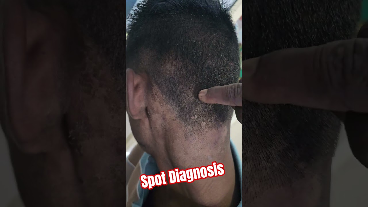 Диагностика на месте 