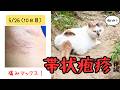【廃墟の隣に棲む女】 ~帯状疱疹闘病記≪発疹から2週~3週目≫ 痛みと痒みとヒリヒリ感…まだ終わらない魔の手~#39
