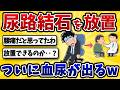 【激痛】尿路結石になったワイ、放置してえらいことになるww【2ch風解説】