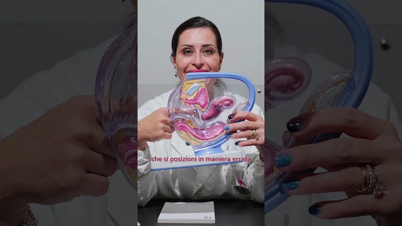 Come si inserisce l'anello 